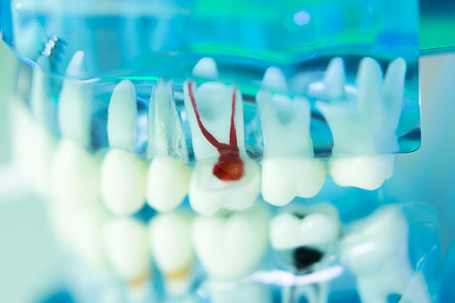 Dentists teaching model displaying a clear view of roots and teeth as they attach to the jawbone.