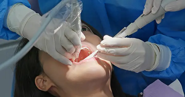 Dentist performing a root canal treatment on a patient using dental tools in a clinical setting.